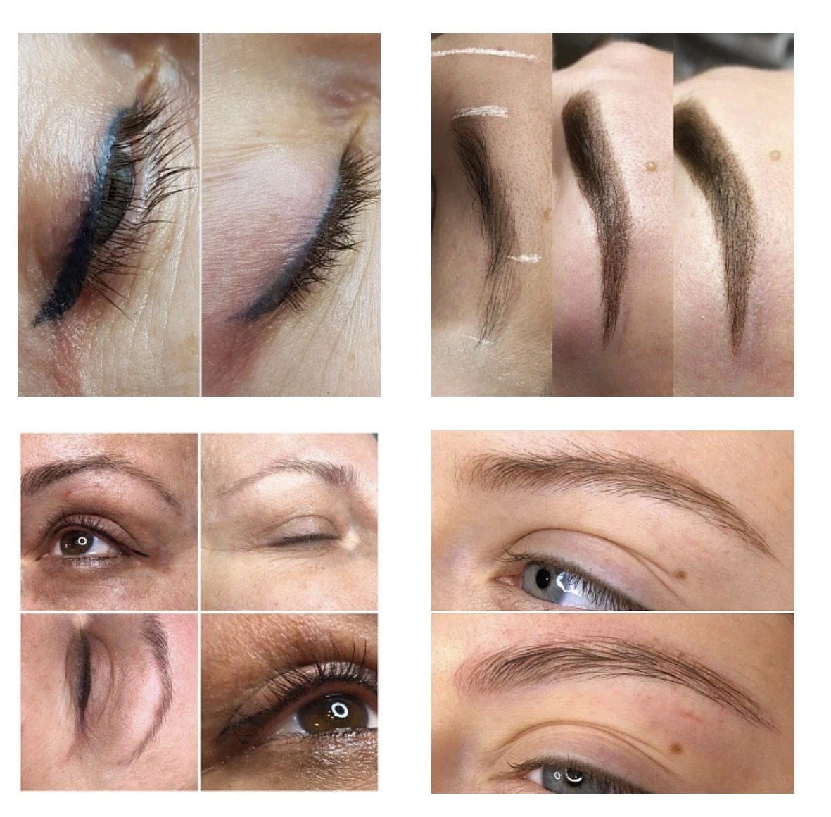 ALKALINE REMOVER  Bild 2